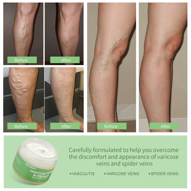 Safflower vein cream for smooth, healthy skin

