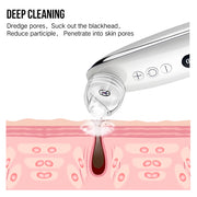Portable blackhead remover for smooth clear skin

