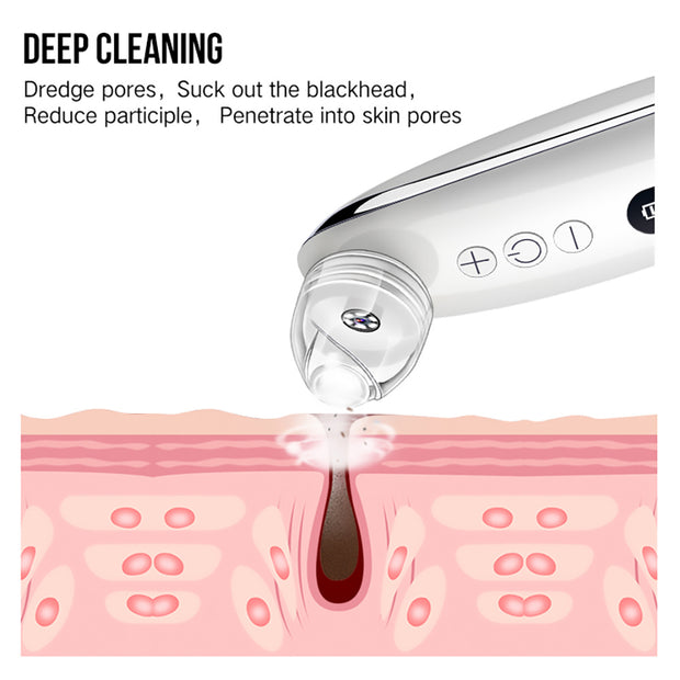 Portable blackhead remover for smooth clear skin

